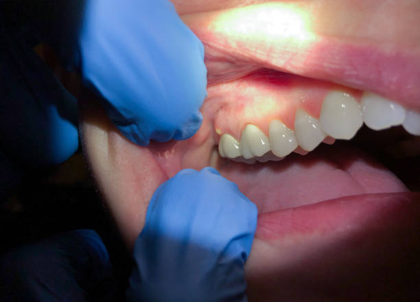 Best Emergency Dentist for Knocked-Out Tooth in , WY